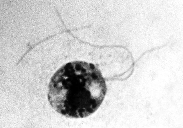 Costia (Ichthyobodo)